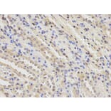 Immunohistochemistry - PGF Antibody from Signalway Antibody (32404) - Antibodies.com