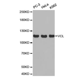 Western blot - VCL Antibody from Signalway Antibody (32418) - Antibodies.com