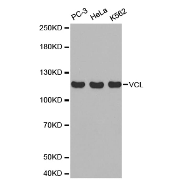 Western blot - VCL Antibody from Signalway Antibody (32418) - Antibodies.com