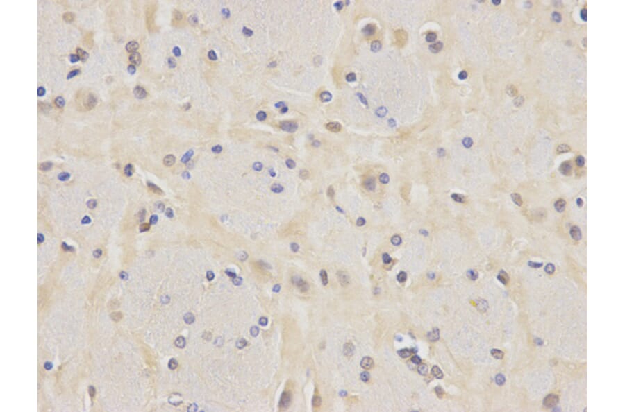 Immunohistochemistry - VCL Antibody from Signalway Antibody (32418) - Antibodies.com