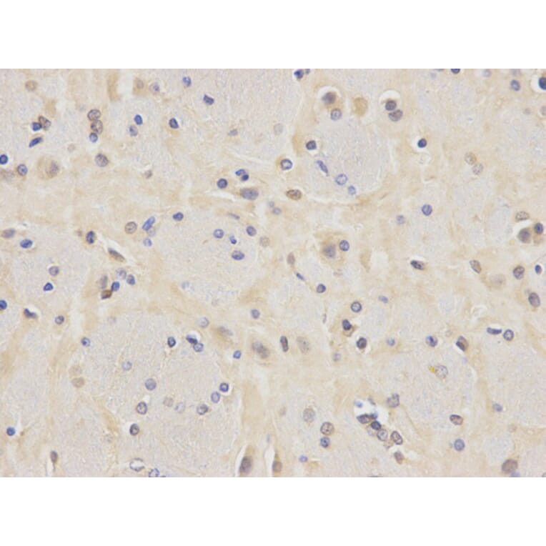 Immunohistochemistry - VCL Antibody from Signalway Antibody (32418) - Antibodies.com