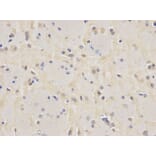 Immunohistochemistry - VCL Antibody from Signalway Antibody (32418) - Antibodies.com