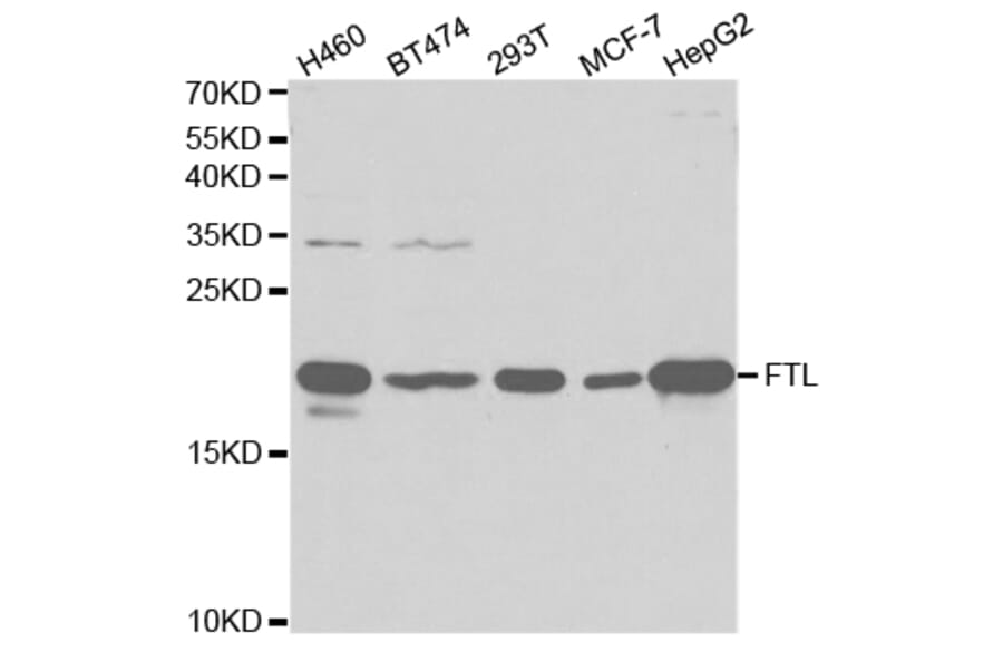 Western blot - FTL Antibody from Signalway Antibody (32425) - Antibodies.com