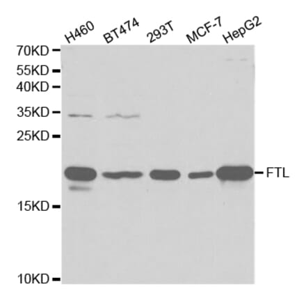 Western blot - FTL Antibody from Signalway Antibody (32425) - Antibodies.com