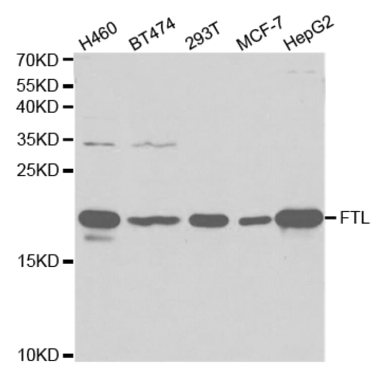Western blot - FTL Antibody from Signalway Antibody (32425) - Antibodies.com