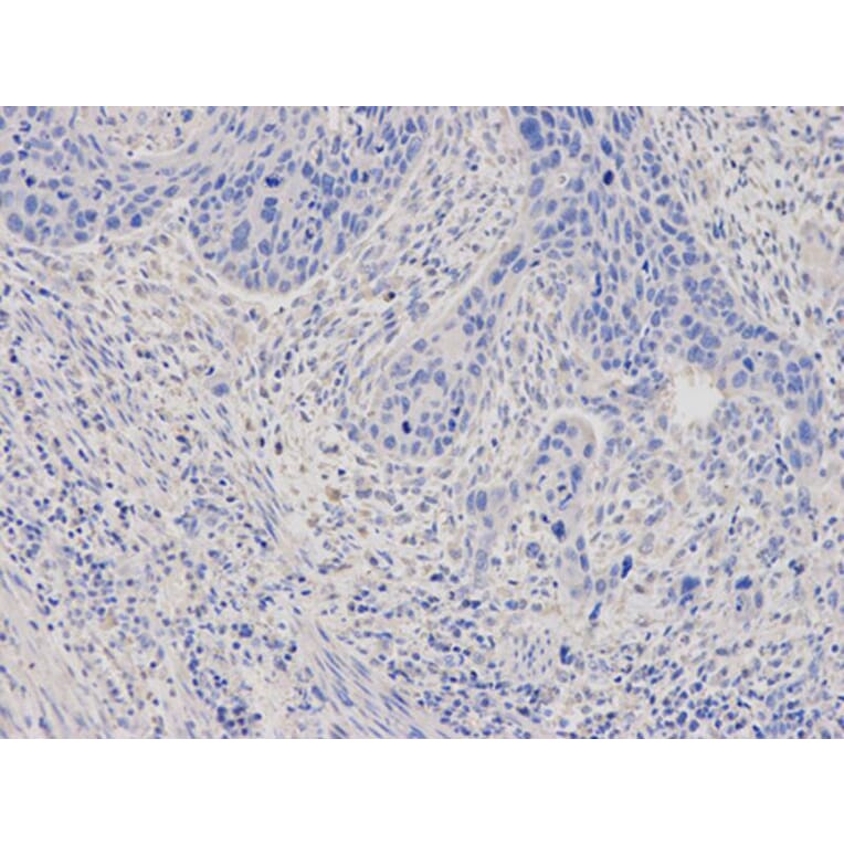 Immunohistochemistry - FTL Antibody from Signalway Antibody (32425) - Antibodies.com