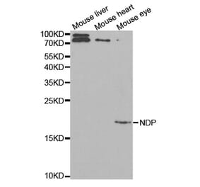 Western blot - NDP Antibody from Signalway Antibody (32523) - Antibodies.com