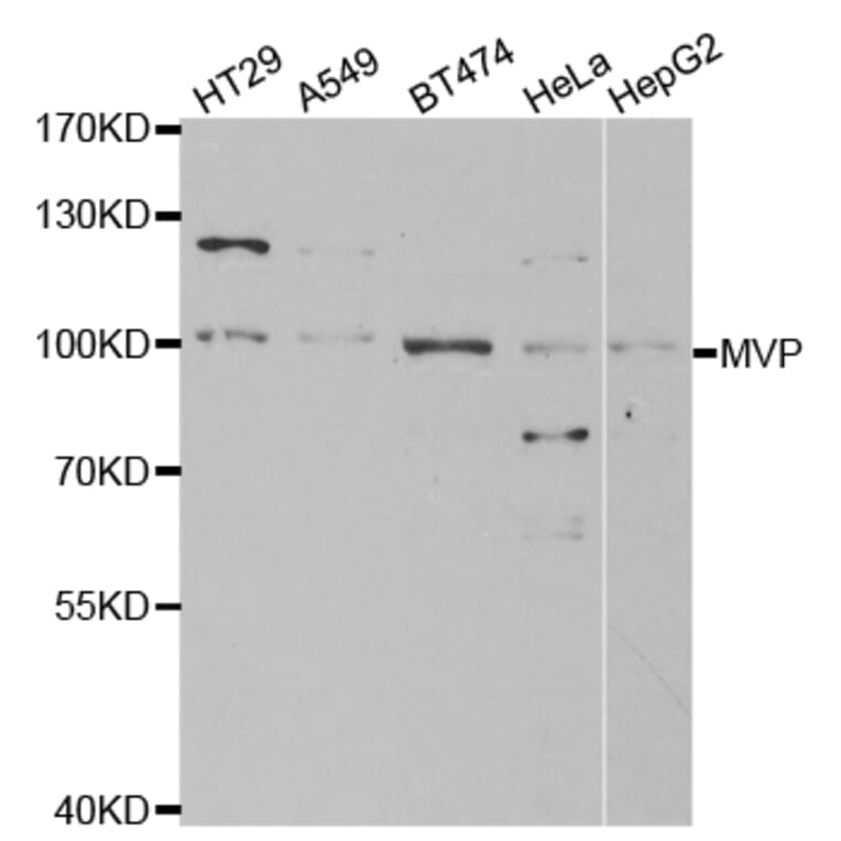 Western blot - MVP Antibody from Signalway Antibody (32533) - Antibodies.com