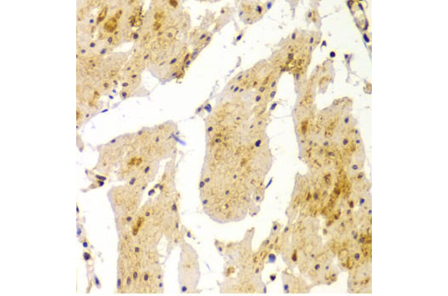 Immunohistochemistry - MVP Antibody from Signalway Antibody (32533) - Antibodies.com