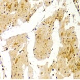 Immunohistochemistry - MVP Antibody from Signalway Antibody (32533) - Antibodies.com