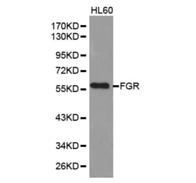 Western blot - FGR Antibody from Signalway Antibody (32587) - Antibodies.com