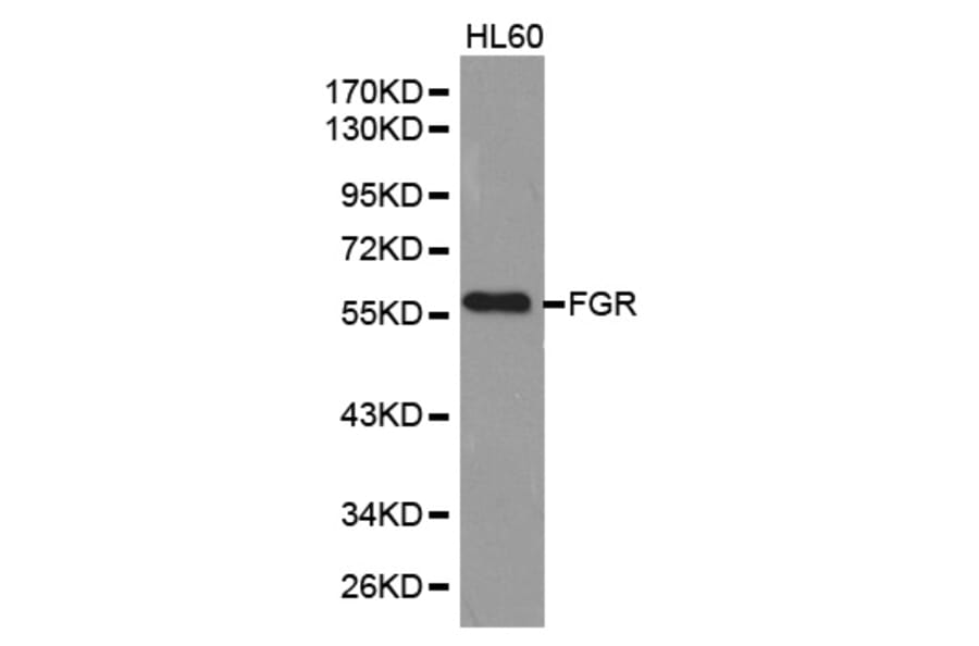 Western blot - FGR Antibody from Signalway Antibody (32587) - Antibodies.com