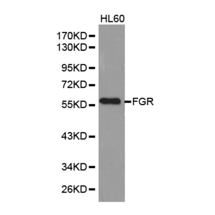 Western blot - FGR Antibody from Signalway Antibody (32587) - Antibodies.com