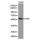 Western blot - FGR Antibody from Signalway Antibody (32587) - Antibodies.com