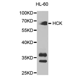 Western blot - HCK Antibody from Signalway Antibody (32589) - Antibodies.com
