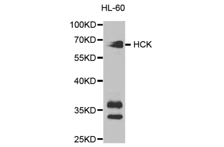 Western blot - HCK Antibody from Signalway Antibody (32589) - Antibodies.com