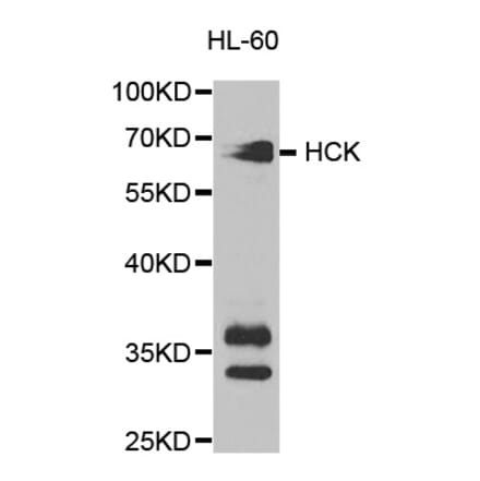 Western blot - HCK Antibody from Signalway Antibody (32589) - Antibodies.com