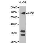 Western blot - HCK Antibody from Signalway Antibody (32589) - Antibodies.com