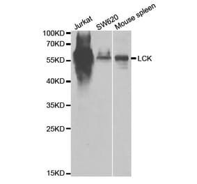 Western blot - LCK Antibody from Signalway Antibody (32644) - Antibodies.com
