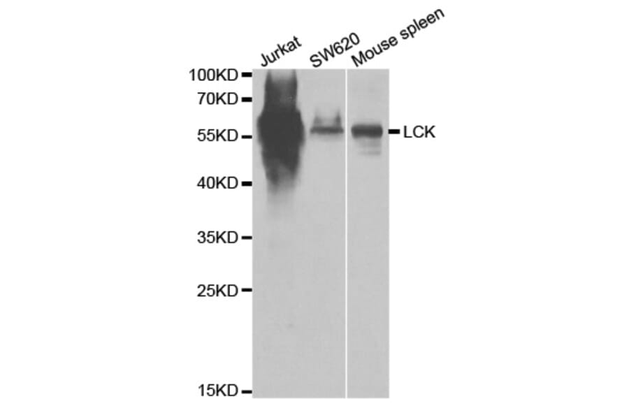Western blot - LCK Antibody from Signalway Antibody (32644) - Antibodies.com
