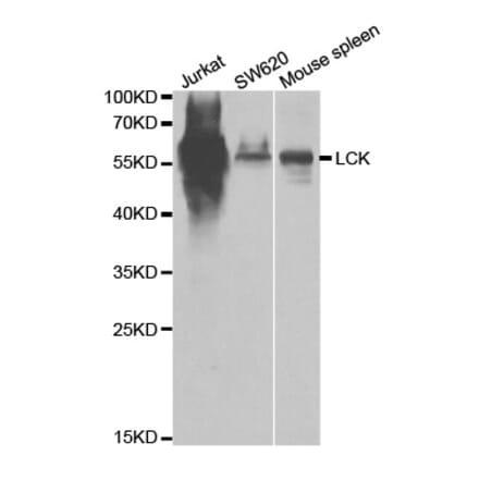 Western blot - LCK Antibody from Signalway Antibody (32644) - Antibodies.com