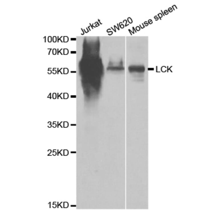 Western blot - LCK Antibody from Signalway Antibody (32644) - Antibodies.com