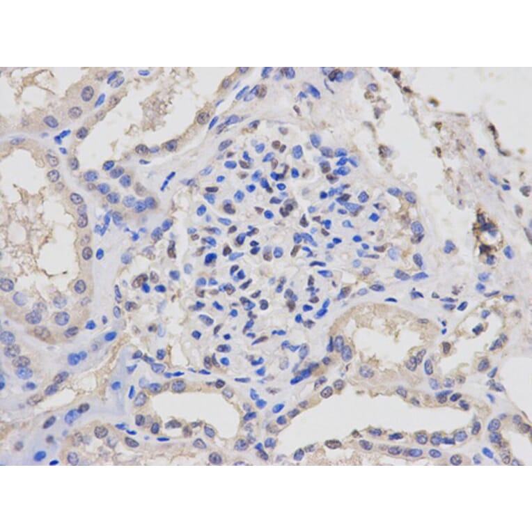Immunohistochemistry - LCK Antibody from Signalway Antibody (32644) - Antibodies.com