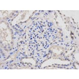 Immunohistochemistry - LCK Antibody from Signalway Antibody (32644) - Antibodies.com