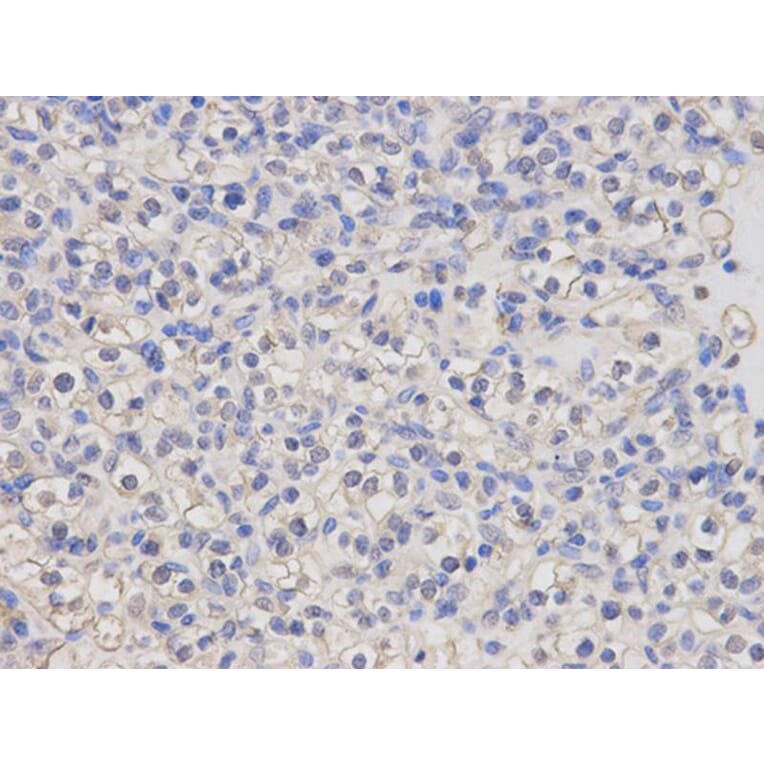 Immunohistochemistry - LCK Antibody from Signalway Antibody (32644) - Antibodies.com