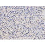 Immunohistochemistry - LCK Antibody from Signalway Antibody (32644) - Antibodies.com
