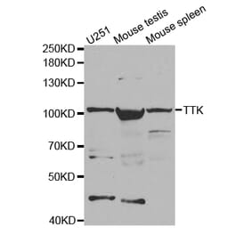 Western blot - TTK Antibody from Signalway Antibody (32677) - Antibodies.com