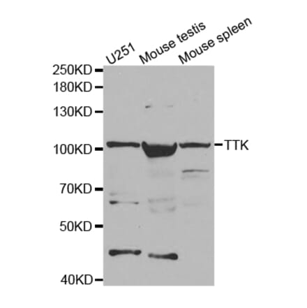 Western blot - TTK Antibody from Signalway Antibody (32677) - Antibodies.com