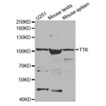 Western blot - TTK Antibody from Signalway Antibody (32677) - Antibodies.com