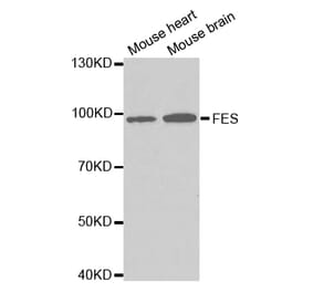 Western blot - FES Antibody from Signalway Antibody (32728) - Antibodies.com