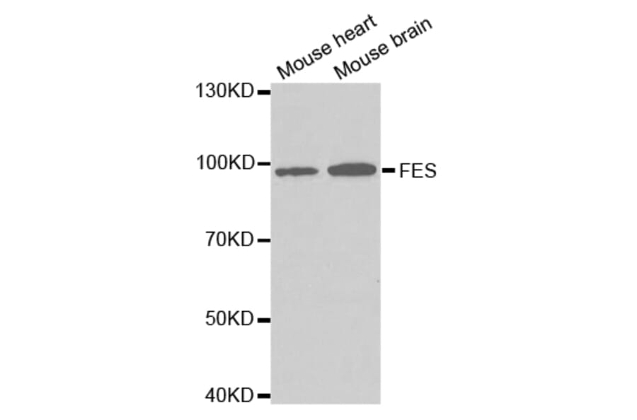 Western blot - FES Antibody from Signalway Antibody (32728) - Antibodies.com