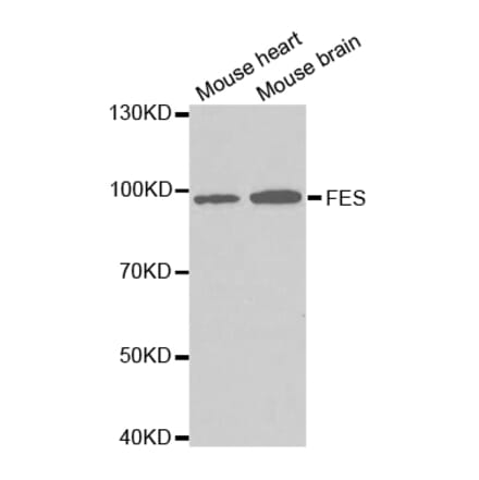 Western blot - FES Antibody from Signalway Antibody (32728) - Antibodies.com