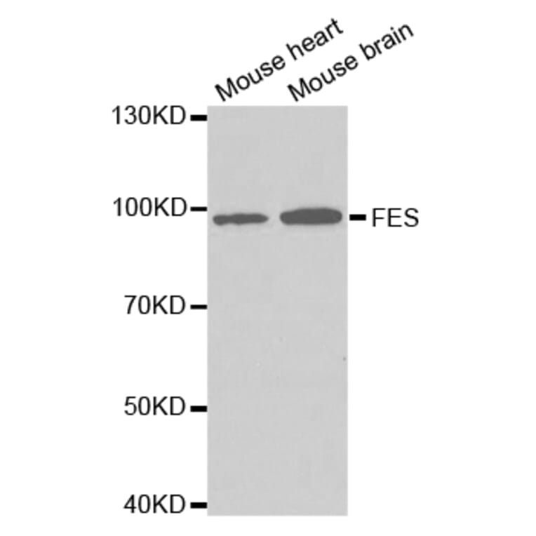 Western blot - FES Antibody from Signalway Antibody (32728) - Antibodies.com