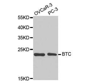 Western blot - BTC Antibody from Signalway Antibody (32736) - Antibodies.com