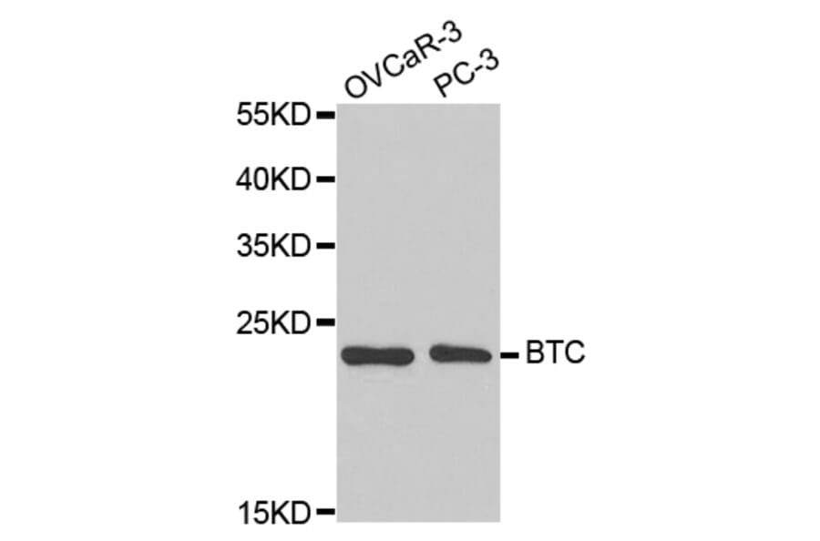 Western blot - BTC Antibody from Signalway Antibody (32736) - Antibodies.com