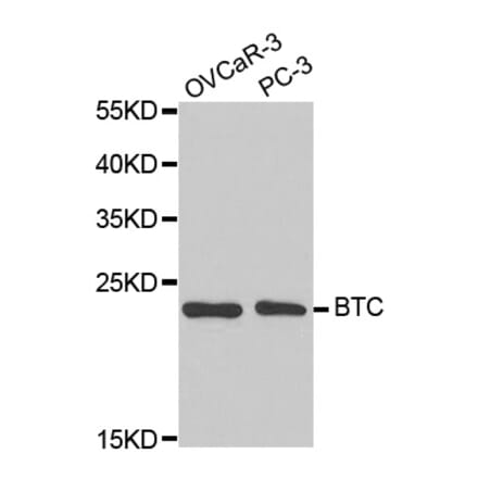 Western blot - BTC Antibody from Signalway Antibody (32736) - Antibodies.com