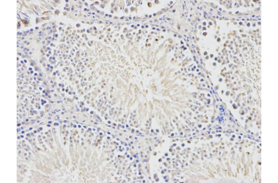 Immunohistochemistry - BTC Antibody from Signalway Antibody (32736) - Antibodies.com