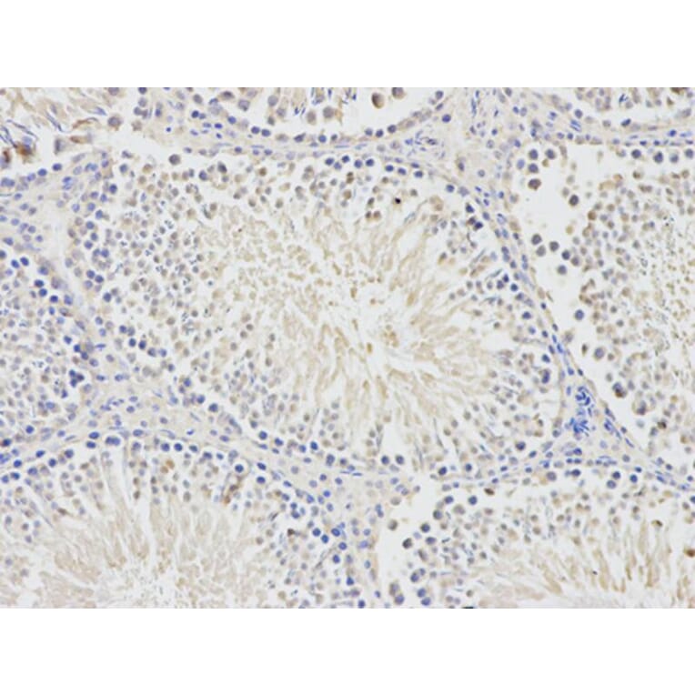 Immunohistochemistry - BTC Antibody from Signalway Antibody (32736) - Antibodies.com