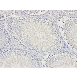 Immunohistochemistry - BTC Antibody from Signalway Antibody (32736) - Antibodies.com