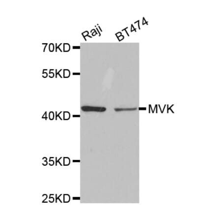 Western blot - MVK Antibody from Signalway Antibody (32794) - Antibodies.com