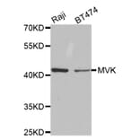 Western blot - MVK Antibody from Signalway Antibody (32794) - Antibodies.com