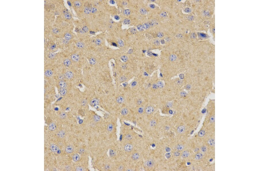 Immunohistochemistry - MVK Antibody from Signalway Antibody (32794) - Antibodies.com