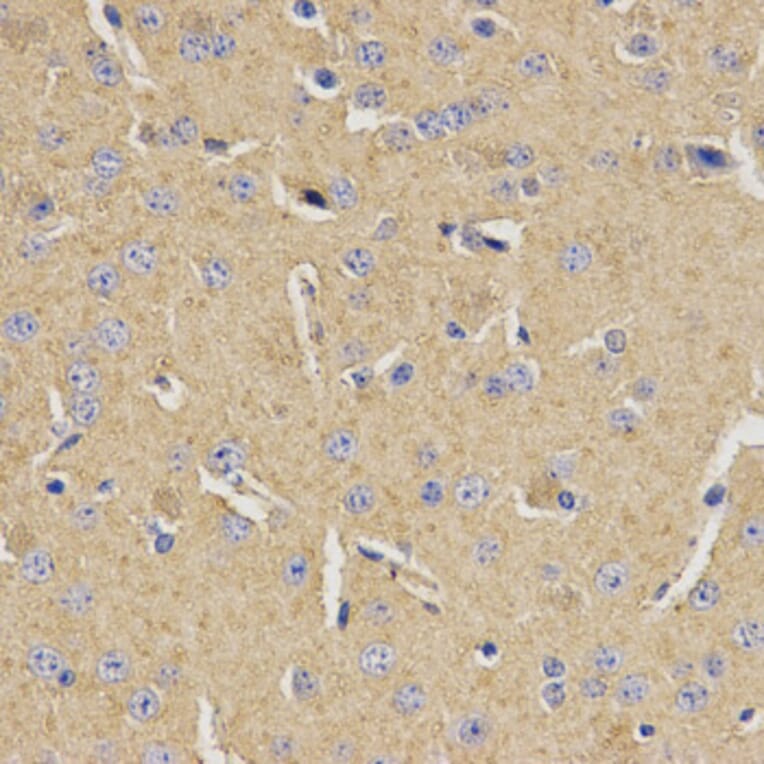 Immunohistochemistry - MVK Antibody from Signalway Antibody (32794) - Antibodies.com
