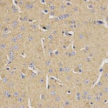 Immunohistochemistry - MVK Antibody from Signalway Antibody (32794) - Antibodies.com