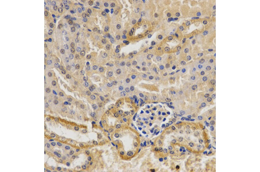 Immunohistochemistry - MVK Antibody from Signalway Antibody (32794) - Antibodies.com