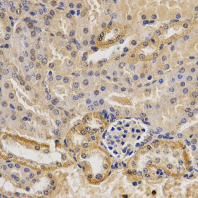 Immunohistochemistry - MVK Antibody from Signalway Antibody (32794) - Antibodies.com